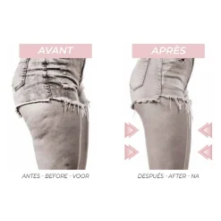 Best Gifi Legging anti cellulite gainant